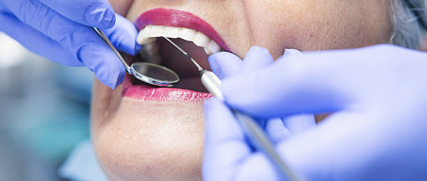 Best Emergency Root Canal Treatment in Boonville, IN